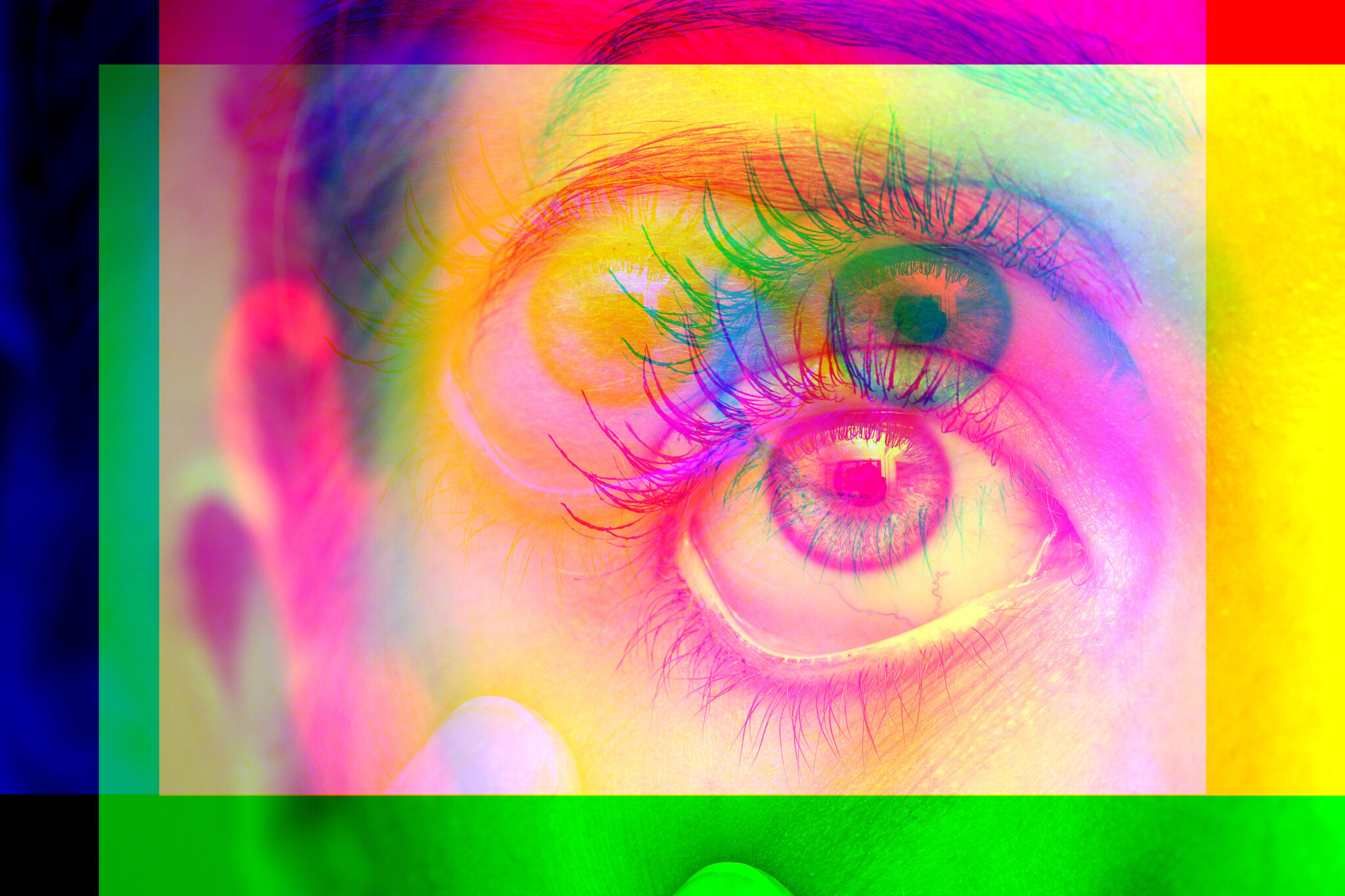 Signos Visuales Raros Enfermedades y Padecimientos mas raros de los Ojos